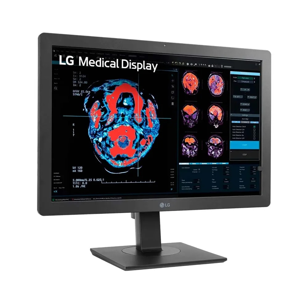 Monitor LGX 24INCH 2MP IPS Diagnostic