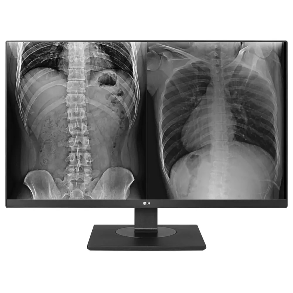 Monitor LG 27INC. 27HJ713C-B IPS 8MP Clinical Negro